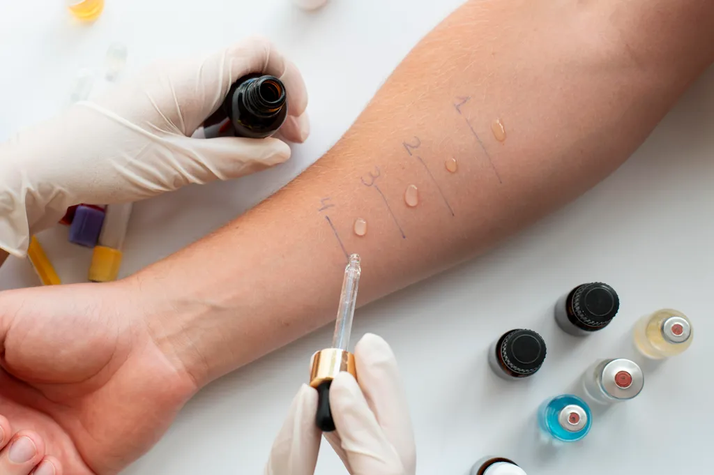 Allergy testing and personalized care at Cure Allergy Clinic