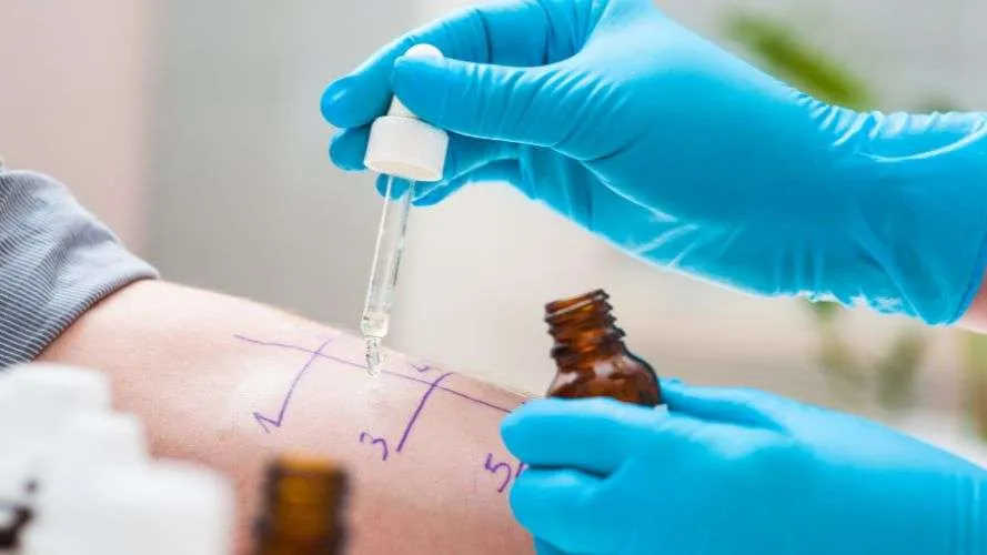 Blood Tests for Allergies – Are They More Accurate?