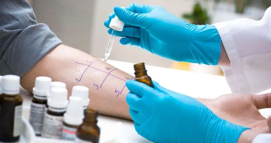 How to Know if You Need Drug Allergy Testing