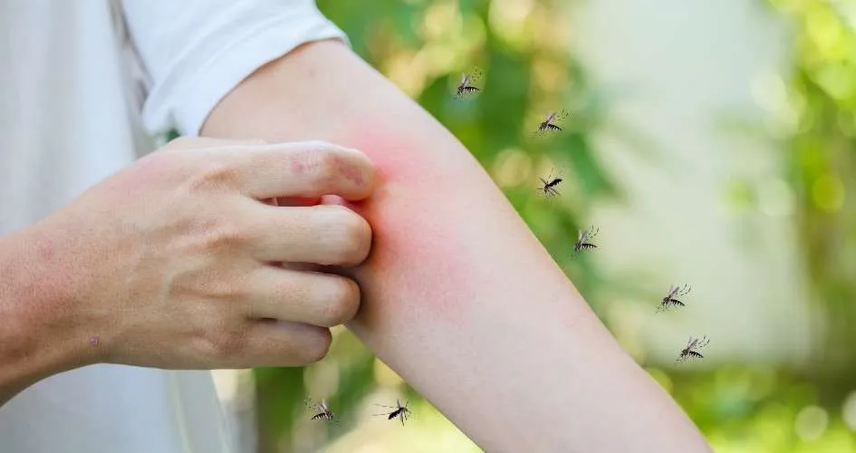 Why Your “Dust Mite Bites” Are Actually a Skin Allergy (and How to Treat It)
