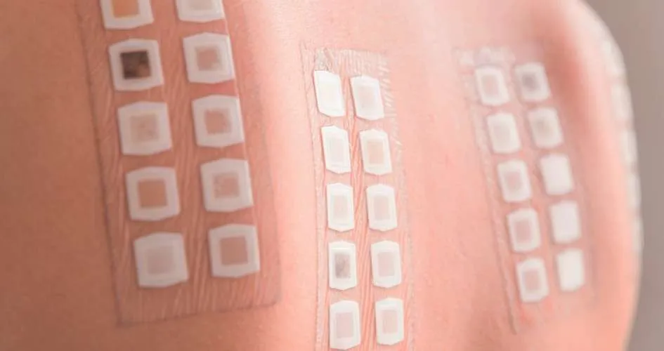 Patch Testing for Metal & Adhesive Rashes: What to Expect