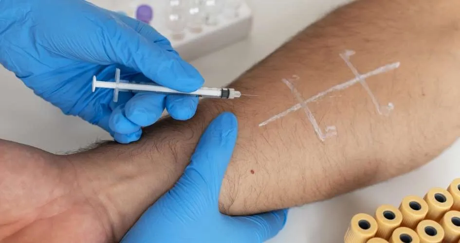 How Long Does It Take for Allergy Shots to Work?