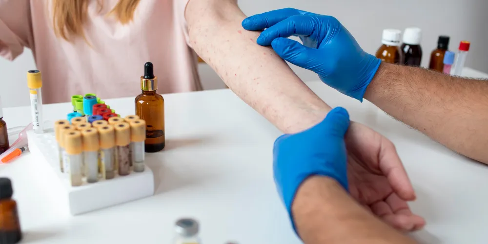 What Happens During an Allergy Test – A Step-by-Step Guide